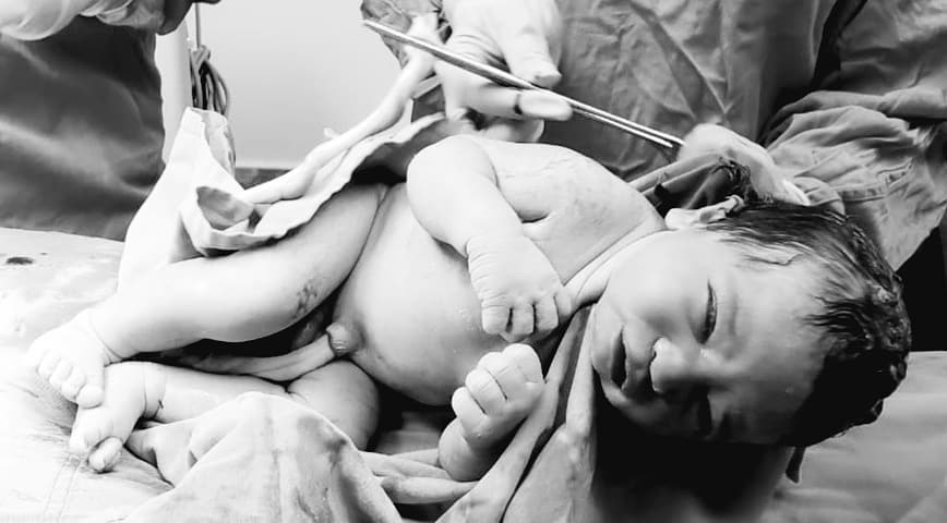 Ginecólogo obstetra (Bebe recién nacido)